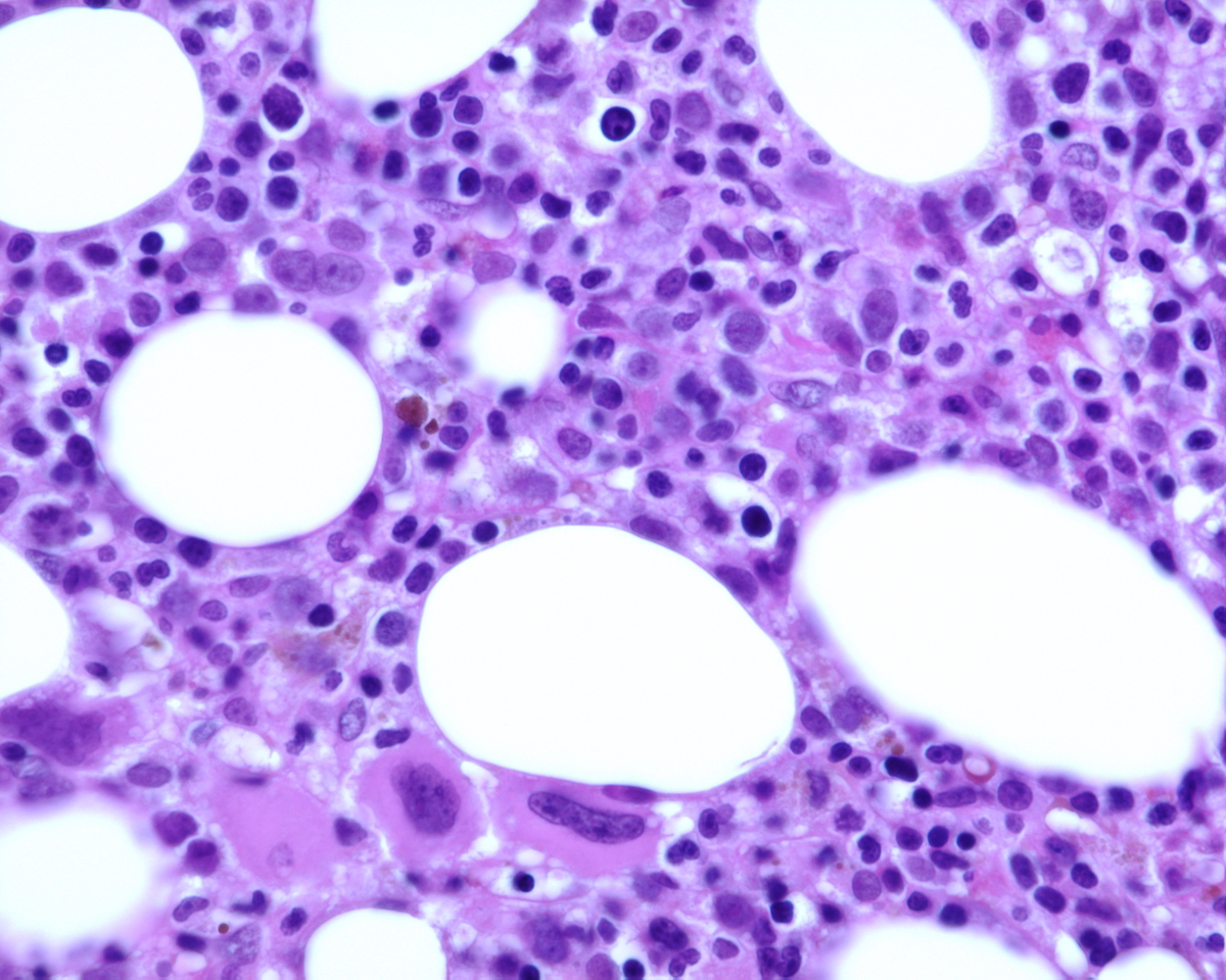 Core BX high power 40X